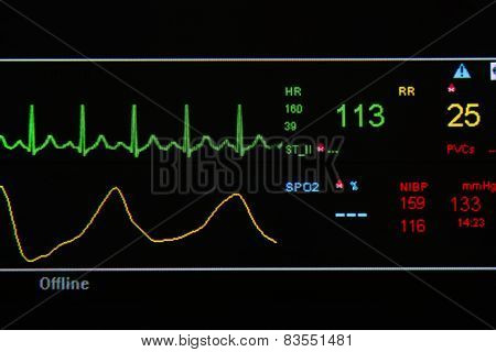 Ekg Monitor In Icu Unit