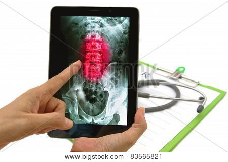 Doctor Looking Lumbar Spine X-ray Image On Tablet For Medical Exam