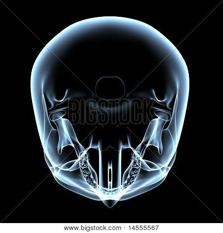Menneskelige kranium - X-ray Top View
