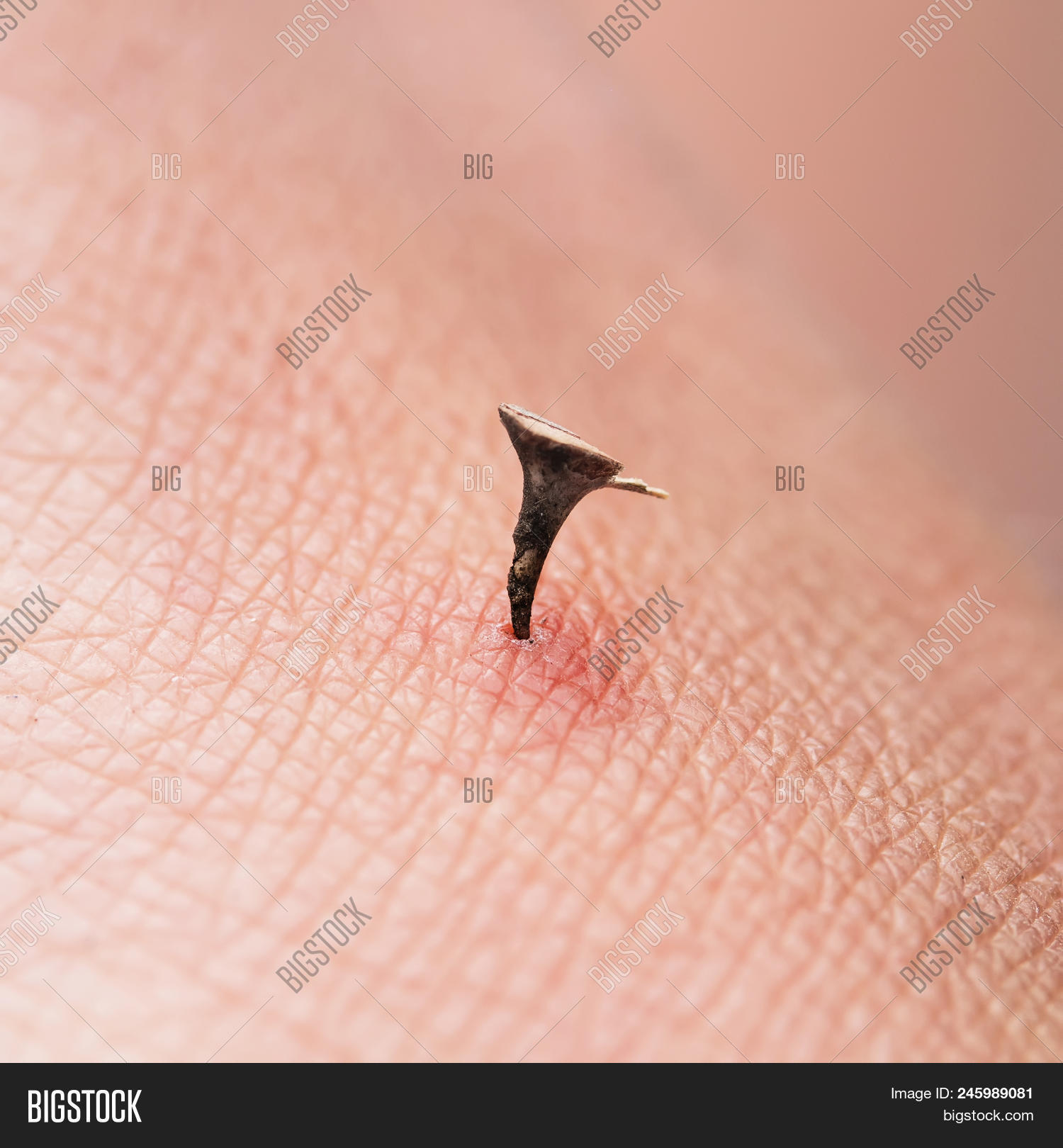 Dirty Strongly Acute Image & Photo (Free Trial) | Bigstock