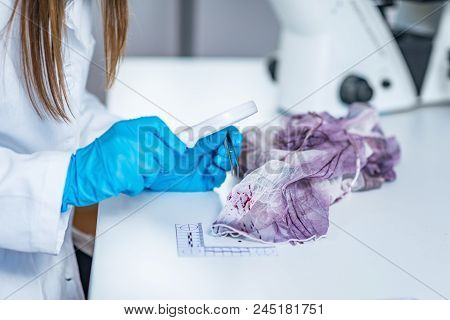 Forensic Science Expert Examining Traces Of Blood On A Piece Of Cloth Collected At A Crime Scene