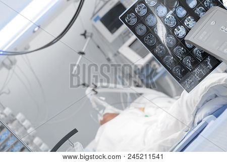 Comatose Patient On The Lung Ventilator In The Intensive Care Unit.