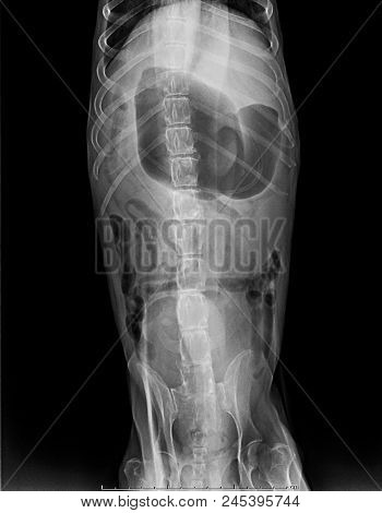 X-ray Of Dog Lateral View With Gastric dilatation Volvulus 