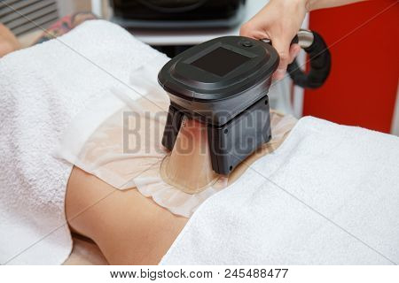 Woman Getting Cryolipolysis Fat Treatment Procedure In Professional Cosmetic Cabinet Or Spa Center, 
