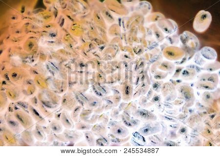 Bacteria Or Cells Under A Microscope, Cells Of The Virus Under A Microscope. Multiplication Of Bacte
