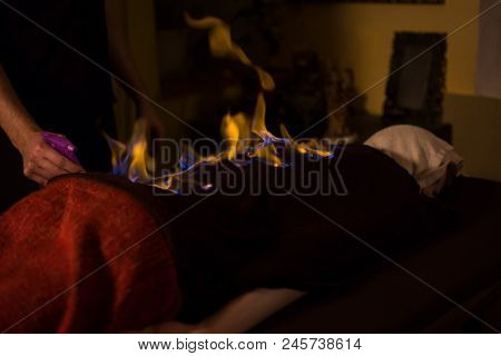 Chinese Fire Massage - Huo Liao Therapy. Traditional Chinese Medicine, Fire Treatment And Bodycare C
