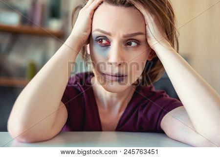 Damaged Woman. Young Beautiful Woman Feeling Extremely Frightened Having Damaged Face After Unexpect