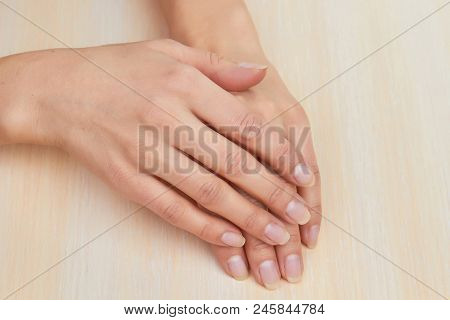 Female Hands With Short Natural Nails. Girl Hands Without Manicure On Salon Table. Skin And Nails Sp