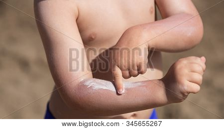 Sun Cream With Spf Sun Protection Factor. Boy Uses Cream. Solar Energy Radiation To Produce Sunburn 
