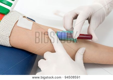 Blood test from vein