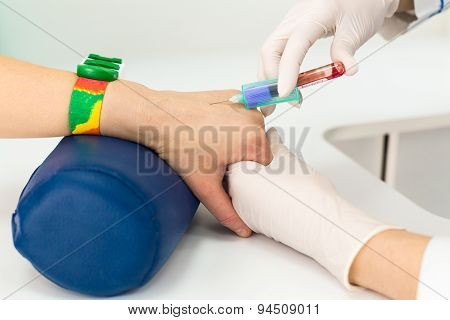 Blood test from vein in hand