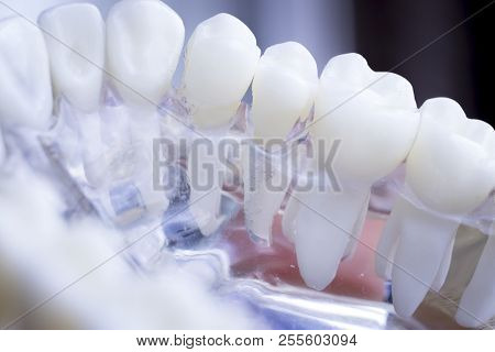 Dentist Dental Teeth Model
