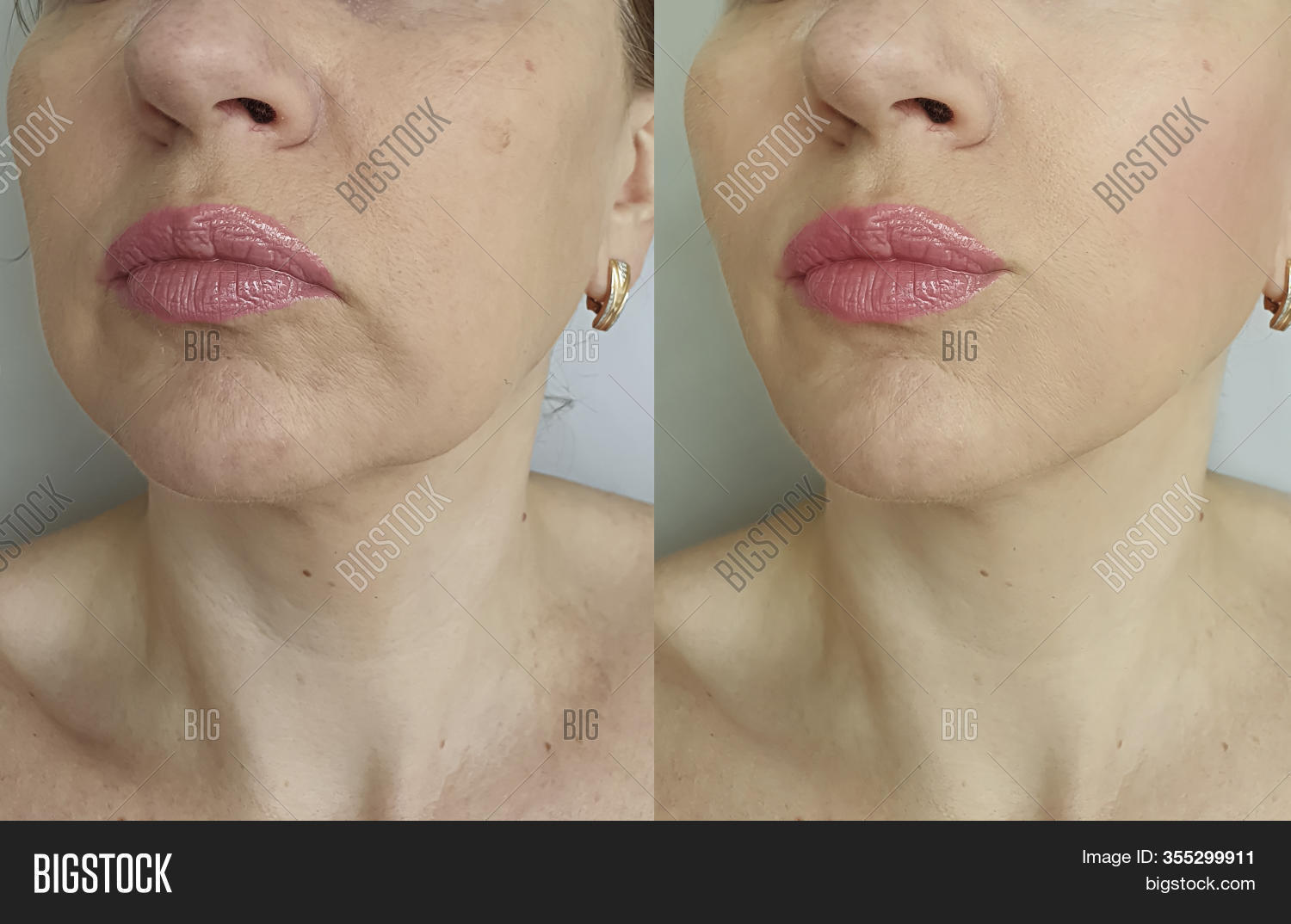 Woman Double Chin Image & Photo (Free Trial) Bigstock