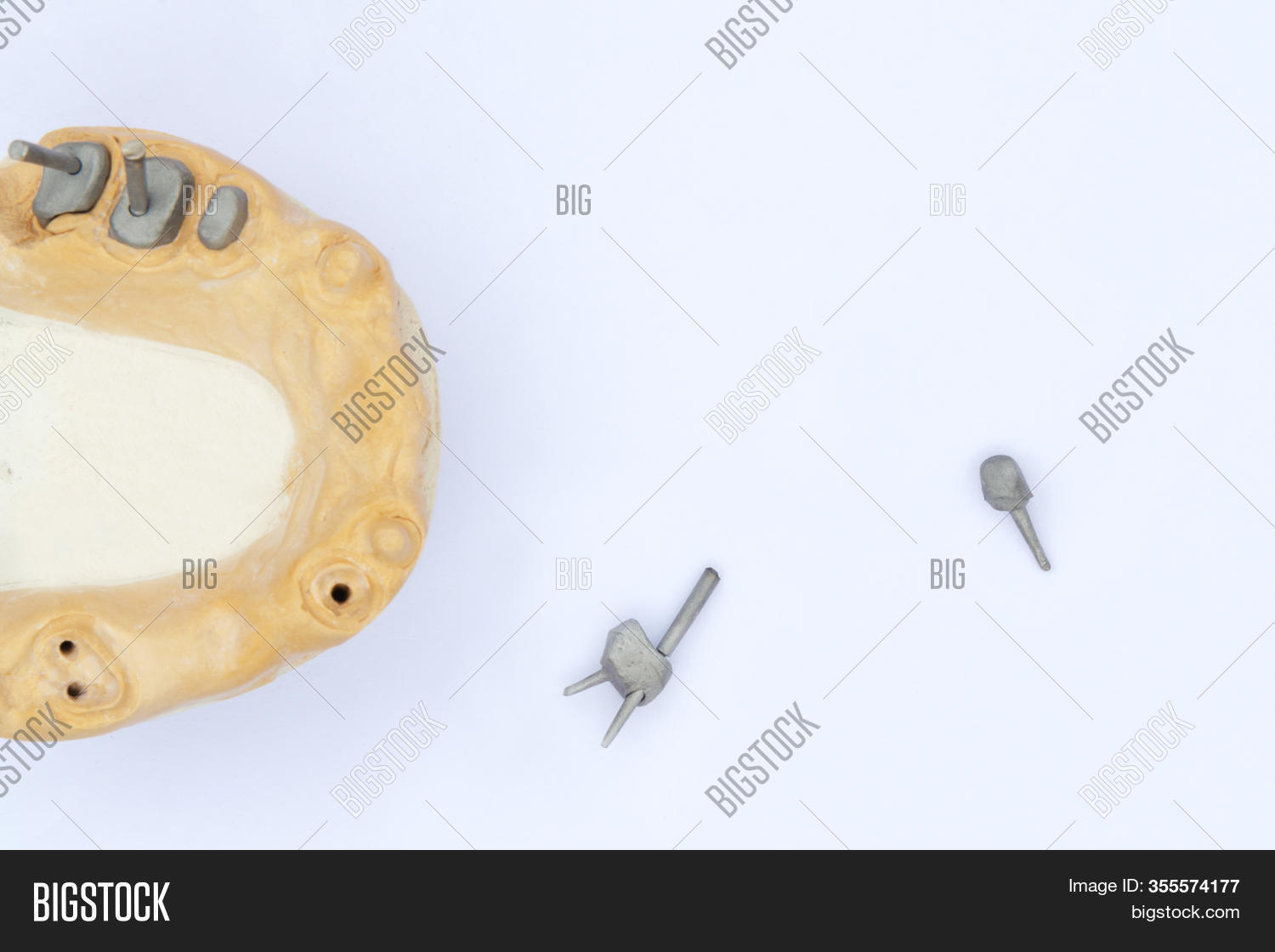 Dental Pins, Posts Image & Photo (Free Trial) Bigstock