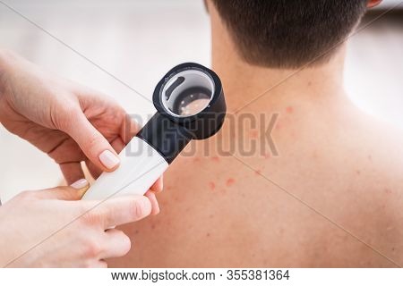 Close-up Of Person Hands Examining Acne Skin Of Man With Dermatoscope