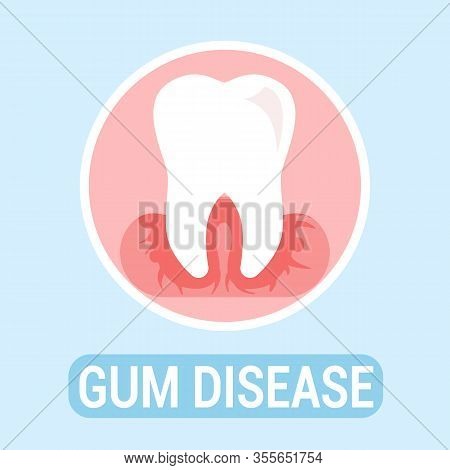 Gums Disease, Dentistry Flat Banner Vector Concept. Dental Clinic, Stomatology Poster. Orthodontic I