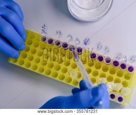 Scientist Working With A Pipette And A Flask, In Plastic Tubes For Dna Studies. Concept Of Science,