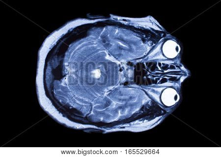 X-ray image of the brain computed tomography, imaging of the brain