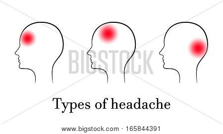 Types of headache, contour medical concept. Vector.