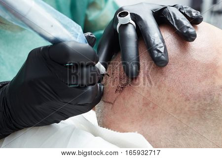 Cosmetologist making permanent makeup on man head - tricopigmentation