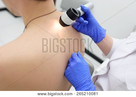 Method Of Dermatoscopy Of Skin Lesions And Moles.