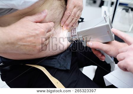 The Dermatologist Examines The Moles Or Acne Of The Patient With A Dermatoscope.