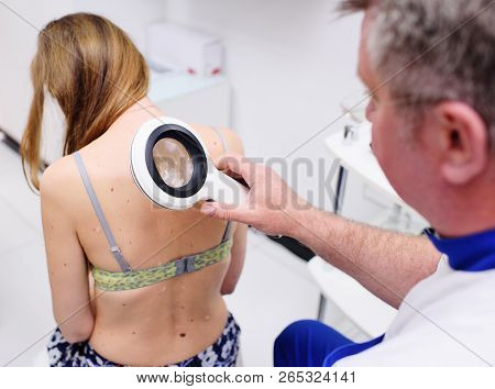 The Doctor Examines The Birthmarks Of The Patient Through A Magnifying Glass