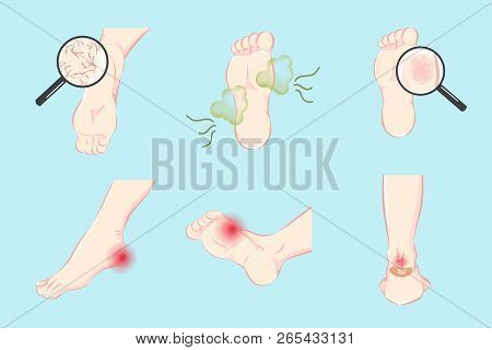All Kinds Of Foot Skin Care Problem Set