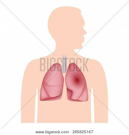 Human Lungs Icon. Realistic Illustration Of Human Lungs Vector Icon For Web Design Isolated On White