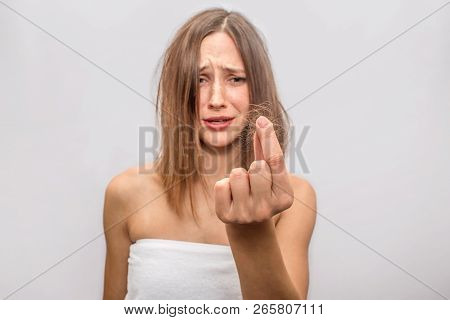 Picture Of Hair Problem That Young Woman Has. There Are Pieces Of Her Hair Between Fingers. She Is F