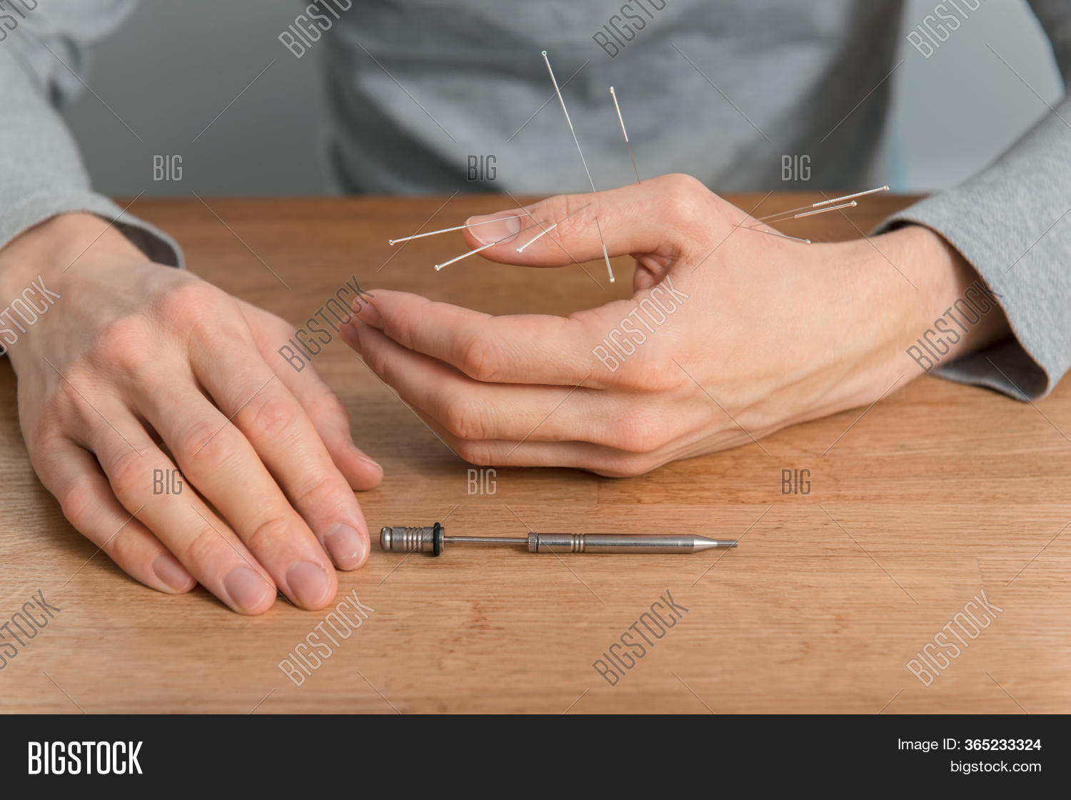 Man Using Acupuncture Image & Photo (Free Trial) Bigstock