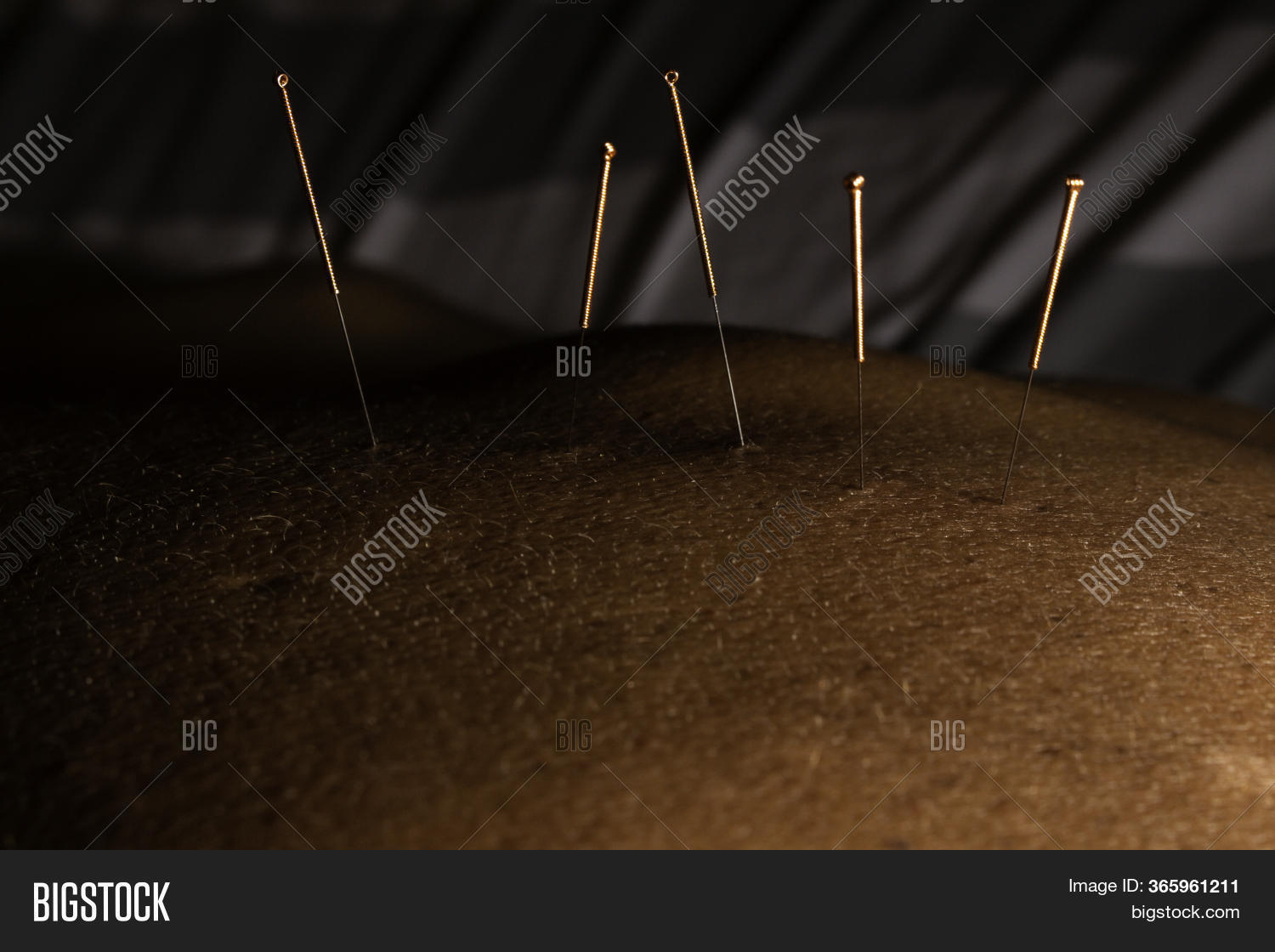 Acupuncture Needles Image & Photo (Free Trial) Bigstock