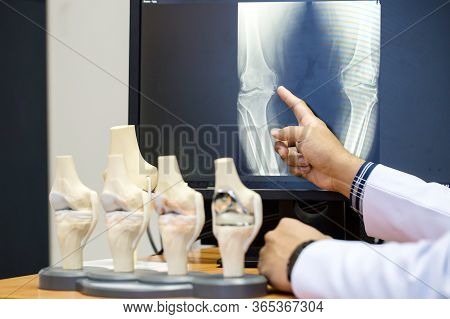 Doctor Pointing On The Knee Problem Point On X-ray Film. X-ray Film Show Skeleton Knee On Film. Surg