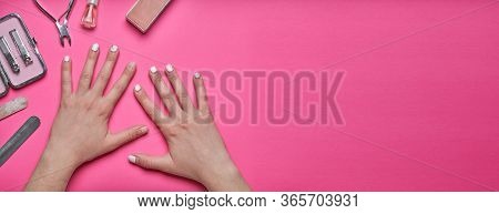 Overgrown Nails With An Old Cracked Gel Polish. Self-removal Of Old Gel Polish From Nails With A Nai