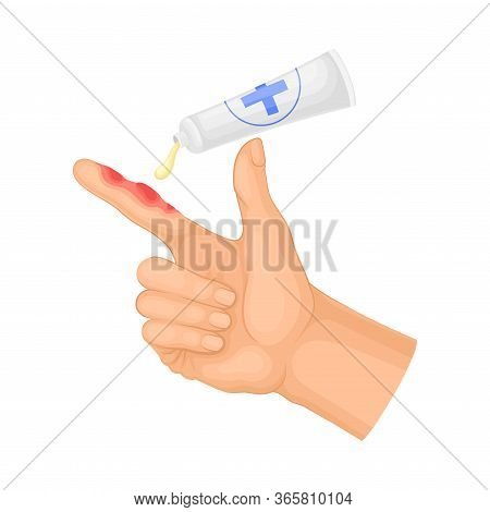 First Aid For Hand With Ambustion Or Burn On The Skin Vector Illustration