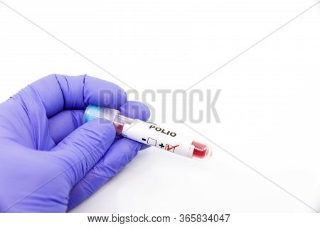 Closeup Of Microbiologist Or Medical Worker Hand With Blue Surgical Gloves Marking Blood Test Result