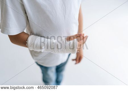 Close-up High-angle View Of Unrecognizable Little Girl With Broken Hand Wrapped In Plaster Bandage S