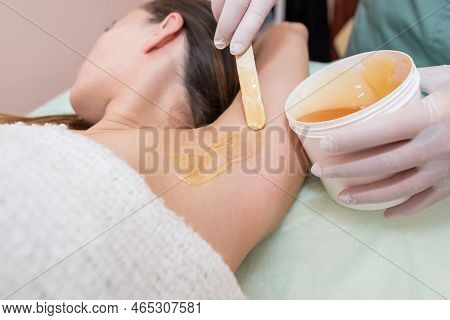 Cosmetology Sugar Hair Removal Of A Female Armpit In A Spa Center. Sugaring: Epilation With Liquid S