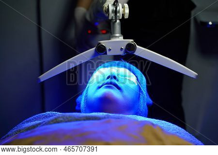 Pdt Photo Dynamic Treatment., Blue Light Helps Treat Acne Inflammation. Kill Bacteria, Reduce Rashes