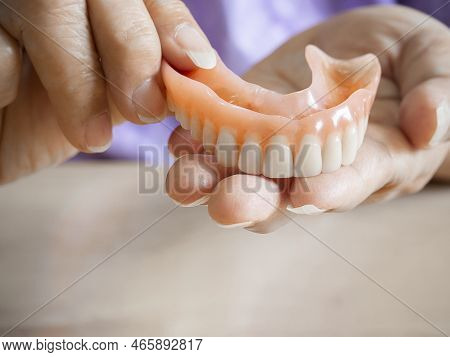 An Elderly Woman Holds A Denture. A Woman Is Holding Dentures In Her Hands. Removable Dentures Flexi
