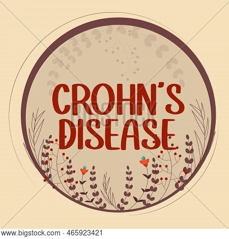 Text Sign Showing Crohn S Is Disease. Conceptual Photo The Chronic Inflammatory Disease Of The Intes