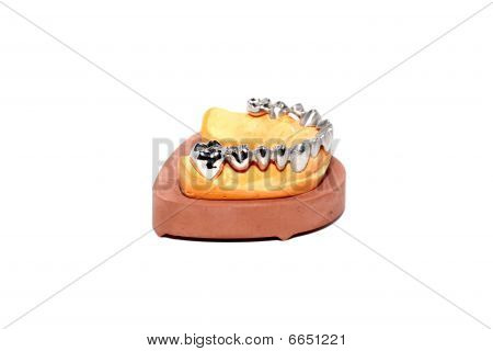 Dental Putz Formen, Zahnersatz