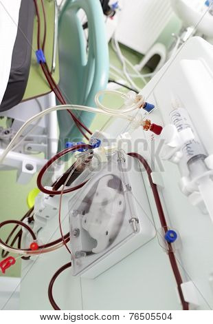 Procedure In Modern Artificial Kidney Machine