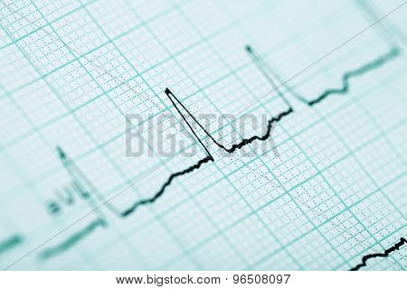 ECG Background