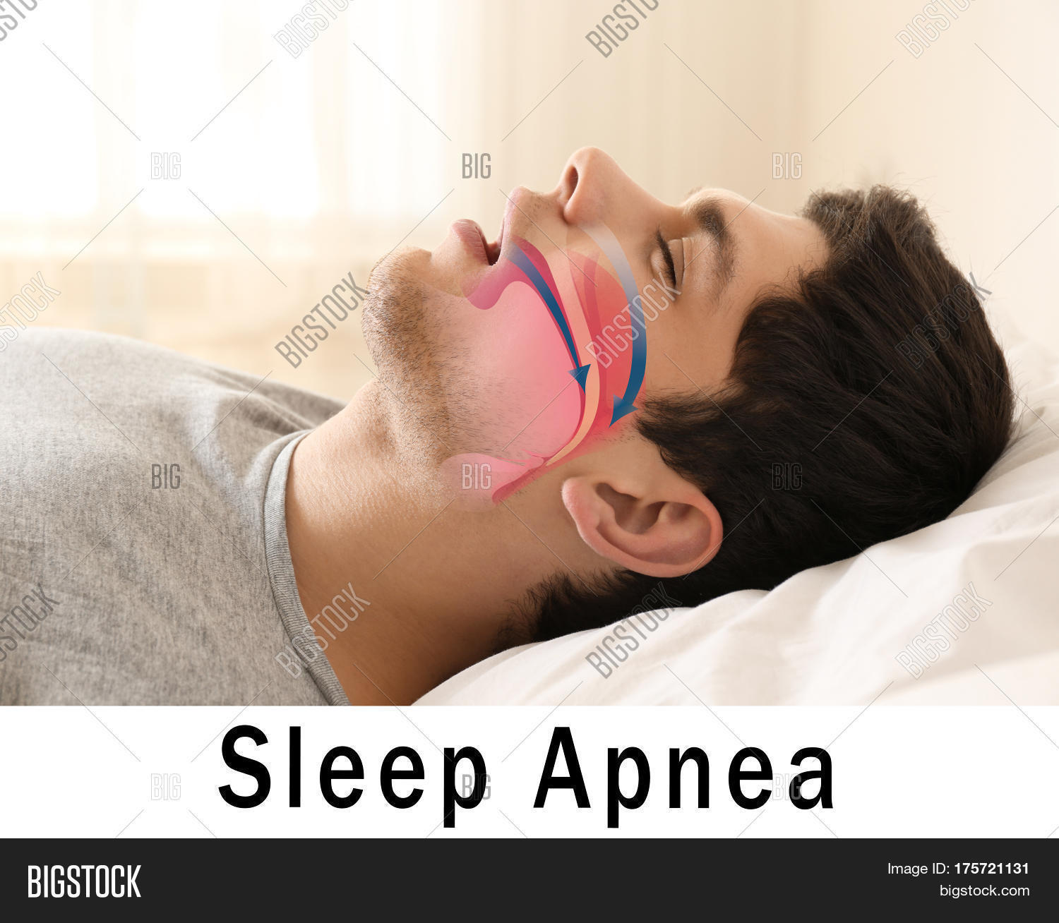 Snore Problem Concept Image & Photo (Free Trial) Bigstock