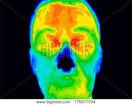 Thermographic image of a human face showing different temperatures in a range of colors from blue showing cold to red showing hot which can indicate inflammation.
