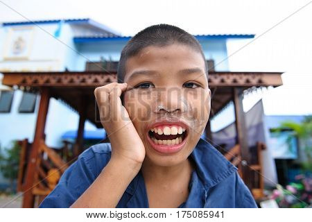 Thai Disability Boy
