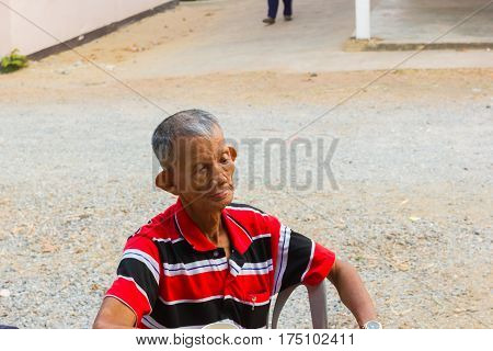 CHIANG RAI THAILAND - MARCH 20 : unidentified old asian leprosy man with sad mood on March 20 2016 in Chiang rai Thailand.