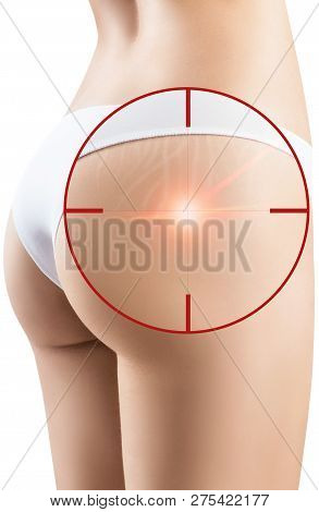 Female Buttocks With Laser Ray Into Aim Removes Stretchmarks. Skin Treatment Concept