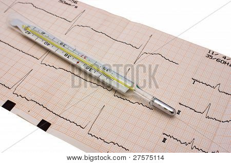 온도계는 cardiogramme와 함께 그래프 종이에
